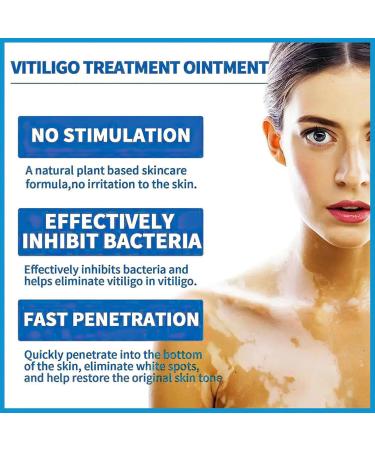 MIELIKKI Vitiligo Cream | Reduce White Spots & Enhance Skin Pigmentation | Natural Vitiligo Care Cream for All Skin Types - Buy Online on GoSupps.com