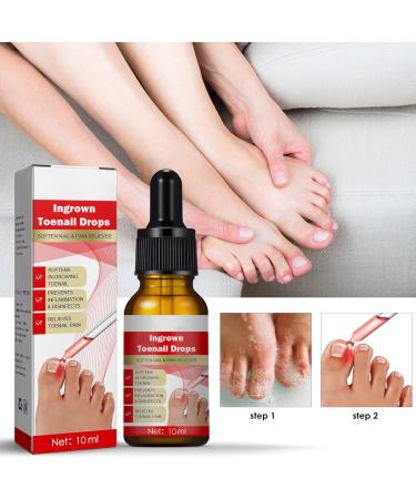 Ingrown Toenail Treatment Nail Growth Ingrowing Toenail Treatment Nail Helper Fungal Nail Treatment Correction Oil Drops Ingrown Toenail Corrector Toe Nail Fungus Treatment Cuticle Oil - Buy Online on GoSupps.com