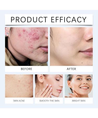 Refreshing & Non-Greasy Facial Cleanser - Gentle Deep Pore Cleaning Moisturizing & Hydrating Face Wash For All Skin Types(2PCS) - Buy Online on GoSupps.com