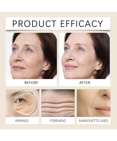  Yoelau Retinol Anti-Wrinkle & Firming Eye Cream - Advanced Eye Care for Dark Circles Puffiness Fine Lines & Under Eye Bags | Moisturizing Firming & - Buy Online on GoSupps.com