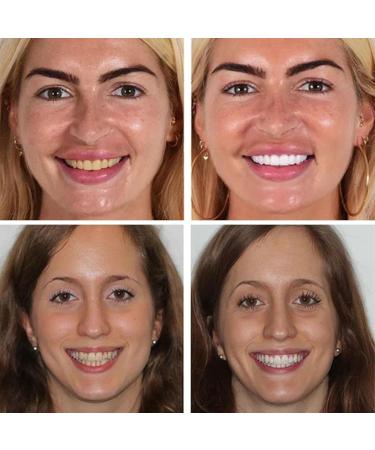 QDHGCFOC Timeless Vanilla Teeth Whitening Pen Teeth Whitening Pen Instant Teeth Whitening Pen Teeth Whitening Essence for Sensitive Teeth - Buy Online on GoSupps.com