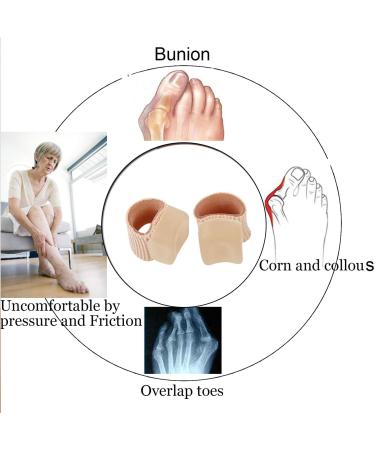 L Size Gel Toe Spacer Separators | Bunion Corrector & Toe Spacers for Overlapping Toe | Soft Gel Lining for Hallux & Bunion Pain Relief - Buy Online on GoSupps.com