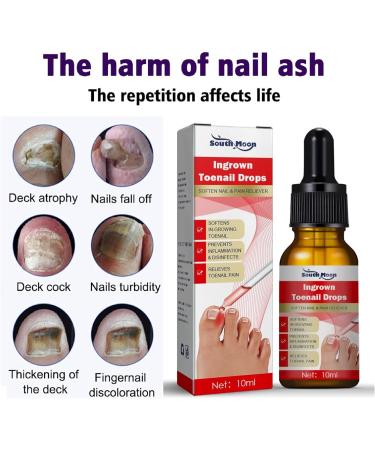 Nail Helper Ingrown Toenail Corrector - Drops for Toenail Correction & Growth Treatment | Fungal Nail & Cuticle Oil Care - Buy Online on GoSupps.com