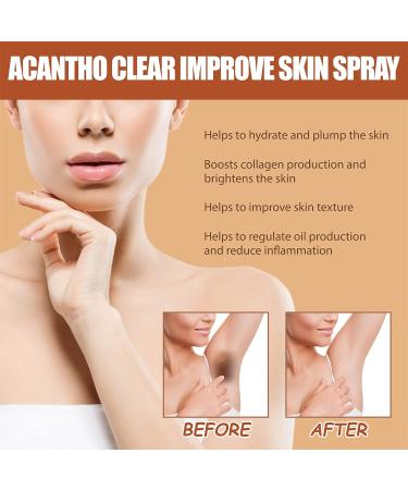 OAKITA Acanthoclear Therapy Spray - Acanthosis Nigricans Treatment for Dark Knuckle - 1PCS/2PCS - Buy Online on GoSupps.com