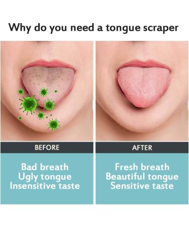 Stainless Steel Tongue Cleaner Set - 2 Pieces for Adults & Children | Effective Tongue Scraping & Hygiene - Buy Online on GoSupps.com