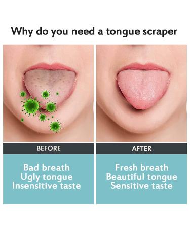 Medical Grade Stainless Steel Tongue Scraper 4 Pack - Oral Care Tool for Adults & Kids - Eliminate Bad Breath - Tongue Cleaner with Mini Hooks - Buy Online on GoSupps.com