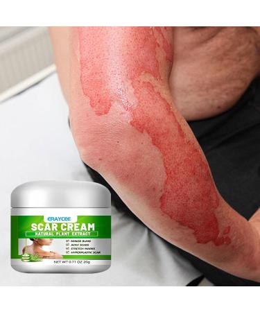 Scar Gel | Natural Calming Moisturizing Aloe Gel for Skin Lightening - Professional Scar Eraser Non-greasy Scar Repair Skin Care for Wounds Sysdisen - Buy Online on GoSupps.com