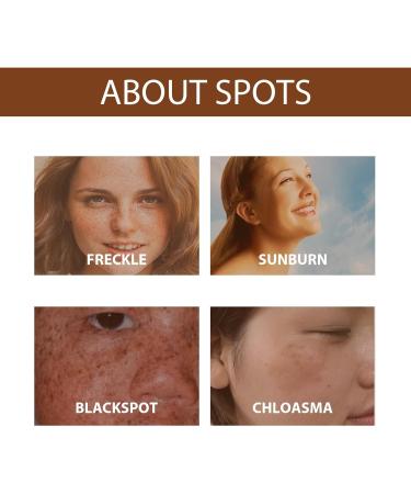 Fade Stain Beauty Cream Freckle Remover Cream Dark Spot Remover for Face Dark Spot Correcting Glow Serum Dark Spots Remover Dark Spot Corrector Cream Age Spot Remover Dark Spot Cream Spot Remover - Buy Online on GoSupps.com