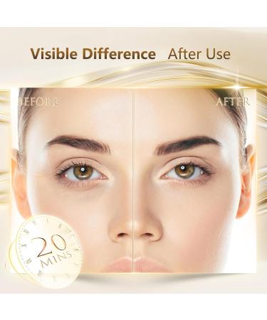 Under Eye Patches for Dark Circles & Puffy Eyes - 36 Pairs Golden Eye Masks with Retinol Collagen Hyaluronic Acid Aloe Vera - Best Eye Treatment for Men & Women - Buy Online on GoSupps.com