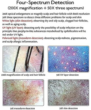 15Inch Skin Diagnosis Hair Analyzer Quad Spectrum Intelligent Dermal Detector Hair Follicle Analyzer for Beauty Salons - Buy Online on GoSupps.com