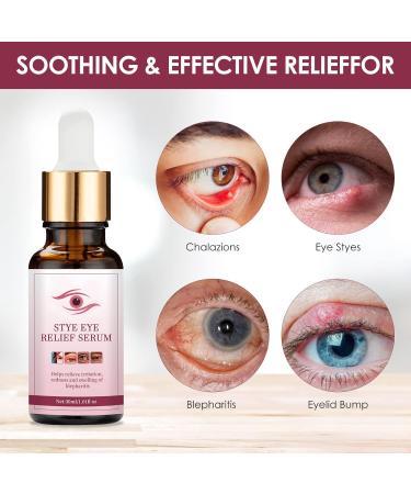 Stye Eye Treatment Chalazion Remover - Fast Relief Serum for Eye Irritation and Eyelid Relief - Buy Online on GoSupps.com