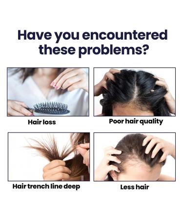 Hair Boost Strengthening Spray - Buy Online on GoSupps.com