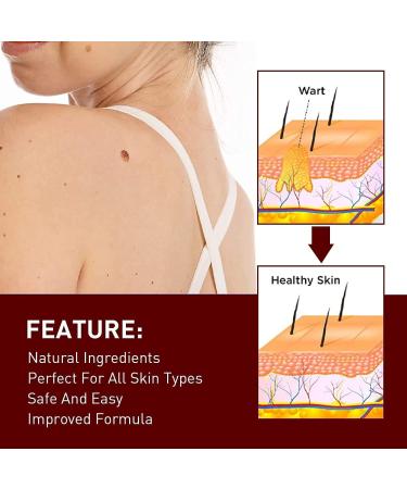 Wipe Off Tags and Mole Remover Skin Tag Remover & Mole Remover for Face Armpit Flesh Neck - Buy Online on GoSupps.com