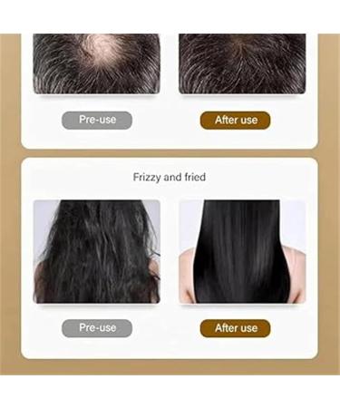 BAInuai Ginseng Shampoo Ginseng Extract Root Nourishing Shampoo Restore Smooth Soft Hair for Men and Women - Buy Online on GoSupps.com