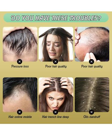 Anti Hair Loss Shampoo for Men - Volumizing & Suitable for All Hair Types (100ML) | International Shipping Available - Buy Online on GoSupps.com