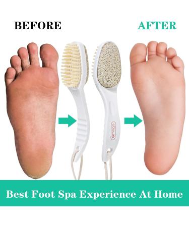 Buy 2 in 1 Foot Pumice Stone Brush - Exfoliator & Scrubber for Dead Skin & Callus Remover | International Shipping Available - Buy Online on GoSupps.com
