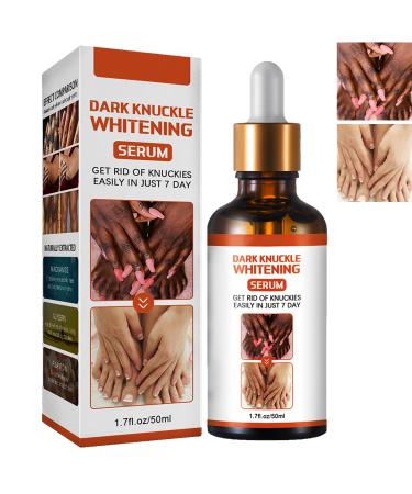 KOAHDE Hand Knuckle Whitening Serums Knuckle Skin Lightening Serums Dark Knuckle Whitening Serums Dark Knuckle Corrector Serums Removing Dark Spots Essence Acanthosis Nigricans Whitening Oil 50ML