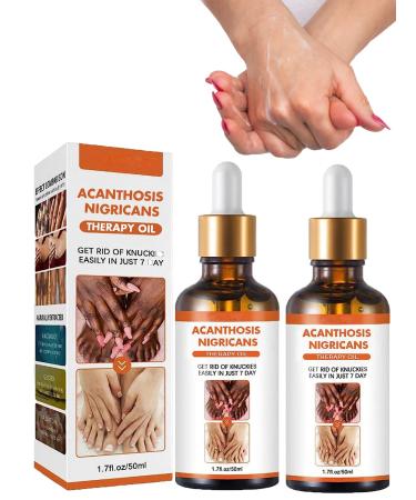 Acanthosis Nigricans Therapy Oil, Dark Spot Corrector Oil Whitening Serum, Dark Spot Remover Lighten Body Black Skin Permanent Whitening (2pcs)