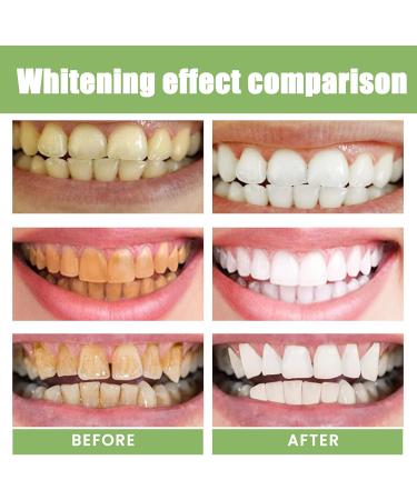 Whitening Toothpaste Ampoule Teeth Whitening Essence 3V Fruit Acid Teeth Whitening Essence Rinse-Free Fresh Breath Remove Tooth Stains Fresh Breath - Buy Online on GoSupps.com