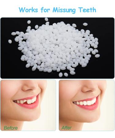 Cailong Instant Veneers & Whitening Kit - 4 Pairs for Snap-On Temporary Tooth Covering & Filling - Sensitive Teeth Friendly - Buy Online on GoSupps.com