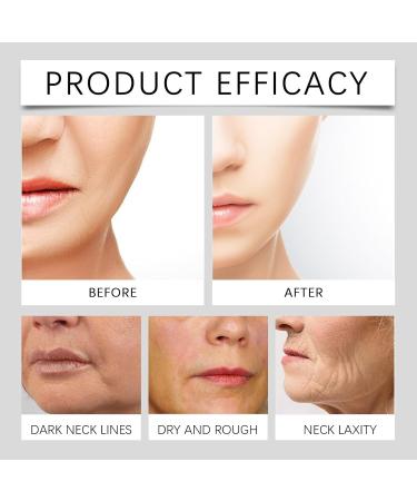 TS TAC-SKY Niacinamide Moisturizing Serum - Facial Hydration Nourishes For Smooth Plump Skin Easy Daily Skincare(2PCS) - Buy Online on GoSupps.com