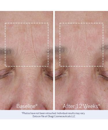 Obagi ELASTIderm Lift Up & Sculpt Facial Moisturizer Clinically Proven Anti-Aging Face Cream that Visibly Firms & Sculpts Facial Contours & Reduces Fine Lines & Wrinkles with Peptides 1.7 oz - Buy Online on GoSupps.com