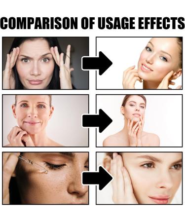 Boto Face Serum UK - Boto Face Serum for Women - Boto Stock Solution B5 - Anti Aging Face Care Serum - Anti Wrinkle Serum - Hydrating Serum 30ml - Reduce Fine Lines Wrinkles Hydrate & Plump Skin - Buy Online on GoSupps.com