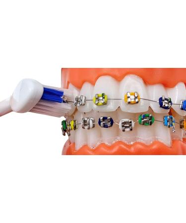 LBailar Rechargeable Braces Toothbrush with 4 Bonus Heads - Buy Online on GoSupps.com