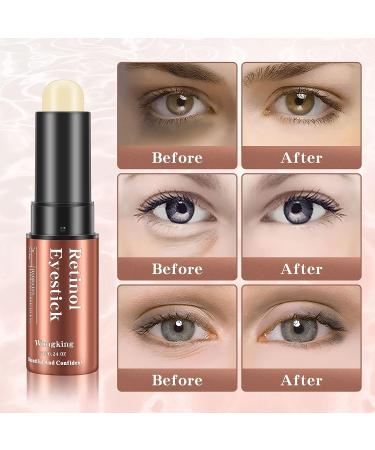 Retinol Eye Stick 0.24oz - Anti-Aging Under Eye Cream for Puffiness, Bags, Dark Circles & Fine Lines - Visible Results in 3-4 Weeks - Buy Online on GoSupps.com