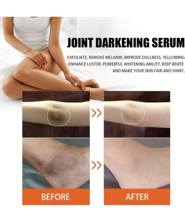 GFOUK Virgin Papaya Seed Oil Pure Natural Virgin Papaya Seed Oil Fights Blemishes Large Pores Relieve Itchy Scaly Irritated Eczema and Psoriasis (1PC) - Buy Online on GoSupps.com