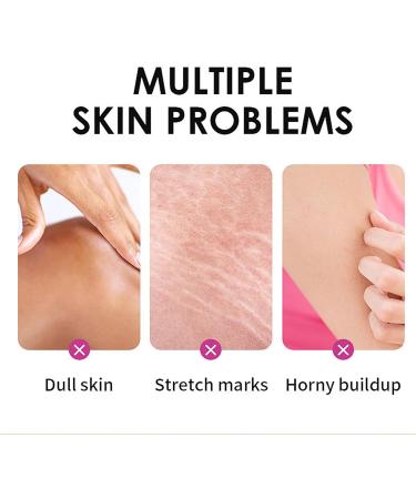 Yellow Peeling Oil - Lightening Exfoliating Dark Skin For Body Strong Peeling Oil Skin Peeling Oil For Skin Lightening Peeling Oil For Skin Brightening Moisturizing Peeling Solution Dark Skin - Buy Online on GoSupps.com