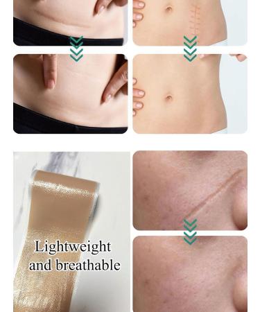 Big Size Silicone Scar Sheets - 3x60'' Roll for Effective Scar Removal | Reusable Silicone Scar Tape for All Types of Scars - Buy Online on GoSupps.com