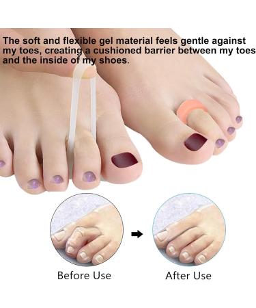 10-Piece Hammer Toe Corrector Set for Men and Women - Gel Straighteners with Separator Loops, Support Crest, Joint Realignment, Cushion Support - Buy Online on GoSupps.com
