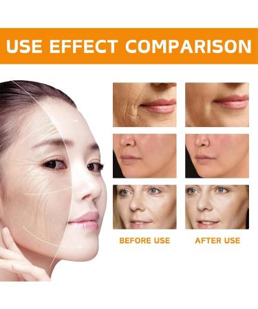 Turmeric Face Cream - Face Moisturizer for Women - Face Moisturiser with Turmeric & Vitamin C - Natural Skincare Ingredient - Anti-Aging Moisturiser Face Women - Dark Spot Remover Face Cream for Women - Buy Online on GoSupps.com