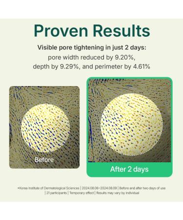 CENTELLIAN 24 Madeca Powder Tea Tree AC (Soothing Powder 0.21 oz) Oil Control & Pore-Tightening for Acne-Prone Skin Korean Skincare with Hyper-TECA Tea Tree & Allantoin 0.5 Ounce (Pack of 2) - Buy Online on GoSupps.com