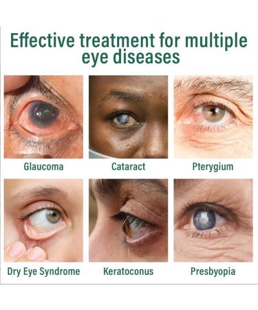 2025 New Nano Eye Drops Serum - Presbyopia Eyes Drop Brightening Eye Drops Relieve Eyes Fatigue for EyesCare Gentle and Effective 30ml/Box (1) - Buy Online on GoSupps.com