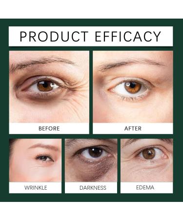 Eye Roller Serum with Mint Essence Vitamin C and Peptides - Energizing Serum for Dark Circles and Puffiness Fine Lines Serum (1pc) - Buy Online on GoSupps.com