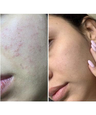 Buy Tonico Aclarante Facial | Best Dark Spot & Blemish Remover | Aqua Labs Colombia - Buy Online on GoSupps.com