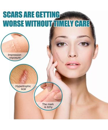 Teksome Scar Tape for Body - 1.5m Stretch Mark Remover Strips | Silicone Gel Tape for Scars & Stretch Marks - Buy Online on GoSupps.com