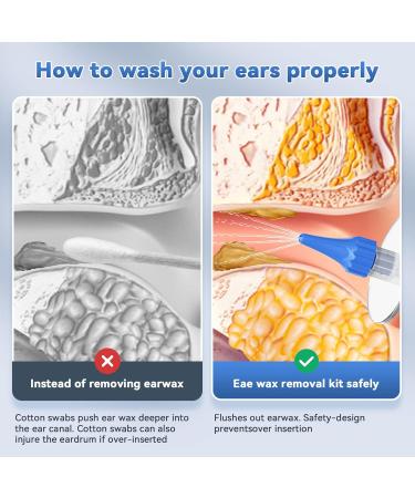 Effective Ear Cleaning Kit for Adults & Kids | Portable & Travel-Friendly with 2 Types of Ear Tips - Buy Online on GoSupps.com