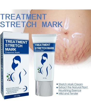 Stretch Strip Repair Cream for Women - Advanced Stretch Mark Removal | Professional Post-Birth Skin Care - Buy Online on GoSupps.com