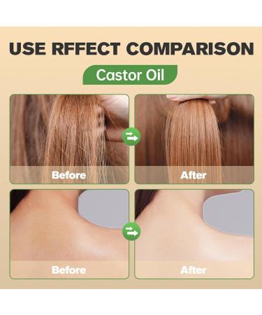 Castor Oil for Hair Growth Organic Castor Oil for Hair Growth Eyelashes and Eyebrows Natural Hair Density Essential Oil Hair Growth Serum for Hair Rapid Growth and Thickening - Buy Online on GoSupps.com