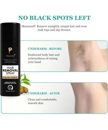 Palians Advanced Hair Removal Spray for Men - Quick & Painless Body Hair Removal - Fast-Acting Gentle Formula with Soothing Aloe & Vitamin E (200 ml (Pack Of 2)) - Buy Online on GoSupps.com