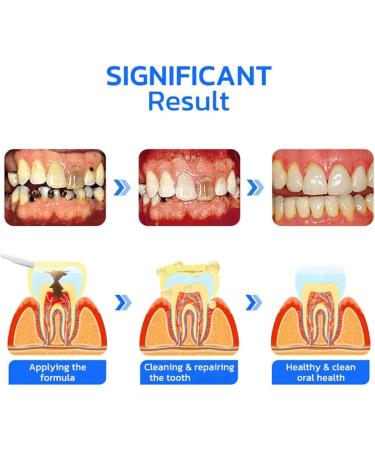 Furzero Propolis Oral Instant Treatment Spray - 2-Pack | Refreshing Breath & Deep Cleaning Mouthwash for Total Teeth Care - Buy Online on GoSupps.com