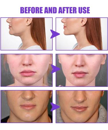  KENANLAN 2 Pcs V Shape Lift Cream Skin Tightening Facial Contour Reshaping Enhance Muscle Masseter Slimming Face Cream 1.1oz - Buy Online on GoSupps.com