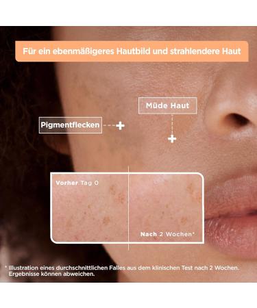  Mixa Mixa Anti-Pigmentation Spot Serum for Uneven Dull and Sensitive Skin with Vitamin C and Niacinamide Suitable for Face and Neck SPF 20 Hypoallergenic 30 ml - Buy Online on GoSupps.com