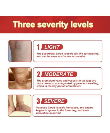 4 & 12 Pieces of Venous Plaster for Varicose & Spider Veins - Improve Blood Circulation & Calm Vasculitis - International Shipping - Buy Online on GoSupps.com