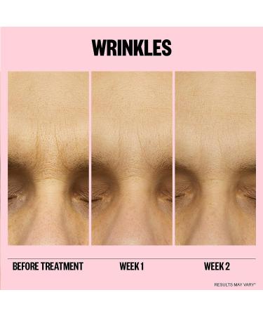 PEACE OUT Skincare Wrinkles: Hyaluronic Acid Microneedling Patches with Retinol, Peptides & Vitamin C - 6 Patches - Buy Online on GoSupps.com