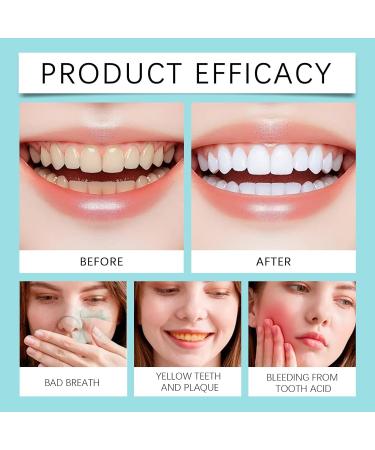 Gentle Cleaning Toothpaste - Removes Stains/Tartar Freshens Breath Repairs Enamel Daily Teeth Care(1PCS) 1 Fl Oz (Pack of 1) - Buy Online on GoSupps.com