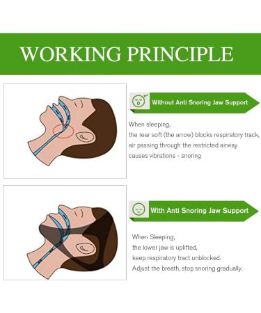 2023 Anti-Snoring Chin Strap - Effective Snoring Stopper | Professional Blue Snoring Equipment - Buy Online on GoSupps.com